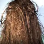 Overdose de proteínas: porque é que os cosméticos revitalizantes tornam